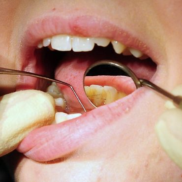 Dental tourism 6 of adults say they have travelled abroad for care
