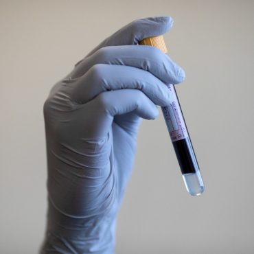 Gene editing therapy for blood disorder recommended for NHS use