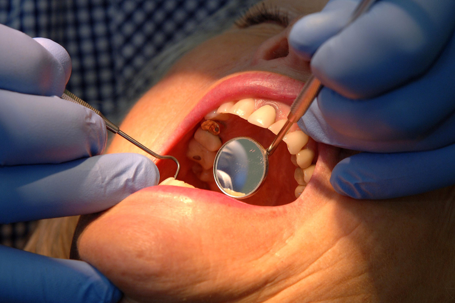Plan to boost NHS dentistry has resulted in worsening the picture