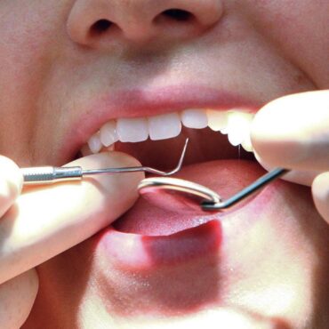 Dentists To Be Paid More To See Urgent Patients Under New Reforms For Sector